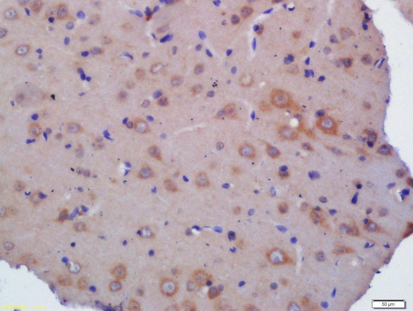 Fig1: Tissue/cell: rat brain tissue; 4% Paraformaldehyde-fixed and paraffin-embedded;; Antigen retrieval: citrate buffer ( 0.01M, pH 6.0 ), Boiling bathing for 15min; Block endogenous peroxidase by 3% Hydrogen peroxide for 30min; Blocking buffer (normal goat serum,C-0005) at 37℃ for 20 min;; Incubation: Anti-KLHL24 Polyclonal Antibody, Unconjugated 1:200, overnight at 4℃, followed by conjugation to the secondary antibody(SP-0023) and DAB(C-0010) staining