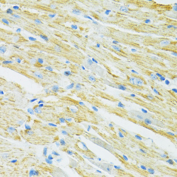 Immunohistochemistry - SLC19A1 Polyclonal Antibody 