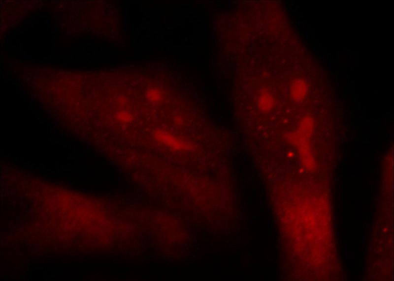 Immunofluorescent analysis of Hela cells, using TOP2B antibody Catalog No:116248 at 1:25 dilution and Rhodamine-labeled goat anti-rabbit IgG (red).