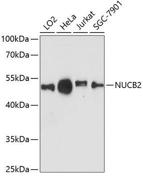 Western blot - NUCB2 Polyclonal Antibody 
