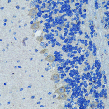 Immunohistochemistry - Nestin Polyclonal Antibody 