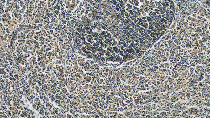 Immunohistochemistry of paraffin-embedded human spleen slide using Catalog No:107495(RAC2 Antibody) at dilution of 1:50