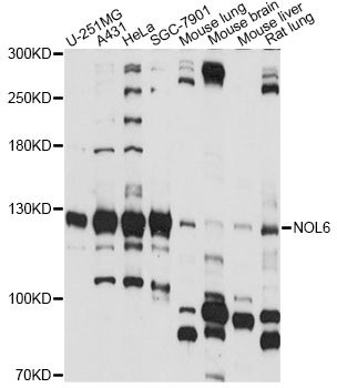 Western blot - NOL6 Polyclonal Antibody 