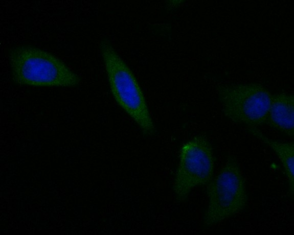 Fig2: ICC staining Osteoproteger in MCF-7 cells (green). The nuclear counter stain is DAPI (blue). Cells were fixed in paraformaldehyde, permeabilised with 0.25% Triton X100/PBS.