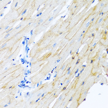 Immunohistochemistry - ADAM17 Polyclonal Antibody 