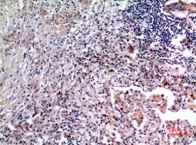 Immunohistochemical analysis of paraffin-embedded human-lung, antibody was diluted at 1:100