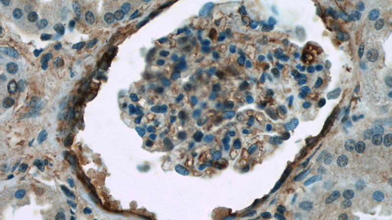 Immunohistochemistry of paraffin-embedded human kidney tissue slide using Catalog No:108249(ARF6-Specific Antibody) at dilution of 1:50 (under 40x lens)