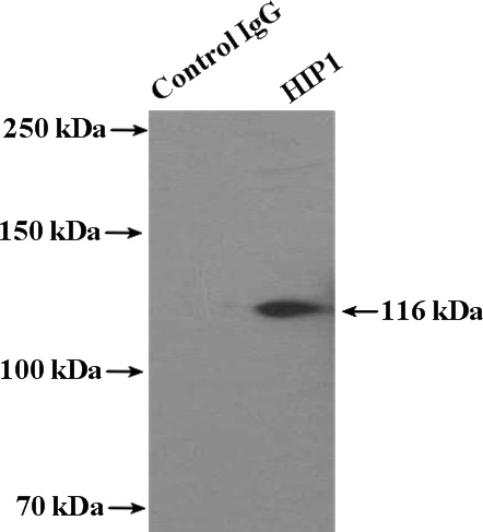 IP Result of anti-HIP1-Specific (IP:Catalog No:111355, 4ug; Detection:Catalog No:111355 1:1000) with HEK-293 cells lysate 2400ug.