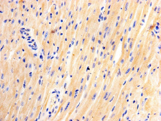 Fig2: Immunohistochemical analysis of paraffin- embedded mouse heart tissue using anti- Junctophilin-2 Mouse mAb (Cat. # 176637#)