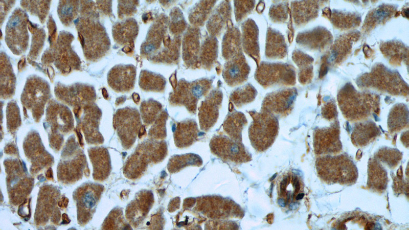 Immunohistochemistry of paraffin-embedded human heart tissue slide using Catalog No:108210(ASB13 Antibody) at dilution of 1:50 (under 40x lens)