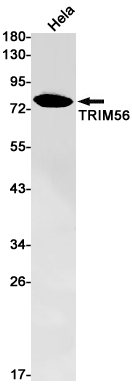 Western blot detection of TRIM56 in Hela cell lysates using TRIM56 Rabbit pAb(1:1000 diluted).Predicted band size:82kDa.Observed band size:82kDa.