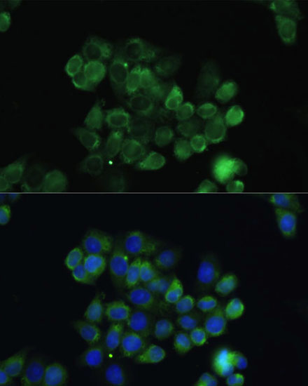 Immunofluorescence - TGFB3 Polyclonal Antibody 