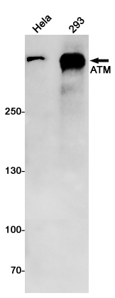 Western blot detection of ATM in Hela,293 cell lysates using ATM Rabbit mAb(1:1000 diluted).Predicted band size:351kDa.Observed band size:351kDa.