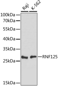 Western blot - RNF125 Polyclonal Antibody 