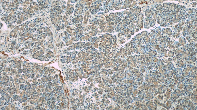 Immunohistochemistry of paraffin-embedded human pancreas slide using Catalog No:115166(SGK1 Antibody) at dilution of 1:50