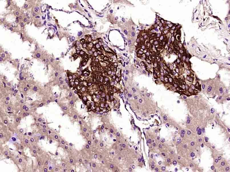 Fig3: Paraformaldehyde-fixed, paraffin embedded (Mouse pancreas); Antigen retrieval by boiling in sodium citrate buffer (pH6.0) for 15min; Block endogenous peroxidase by 3% hydrogen peroxide for 20 minutes; Blocking buffer (normal goat serum) at 37℃ for 30min; Antibody incubation with (TIMP-1) Monoclonal Antibody, Unconjugated at 1:400 overnight at 4℃, followed by operating according to SP Kit(Mouse) (sp-0024) instructionsand DAB staining.