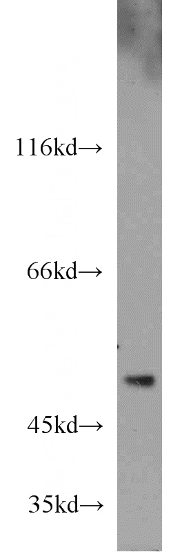 HepG2 cells were subjected to SDS PAGE followed by western blot with Catalog No:110928(GDI2 antibody) at dilution of 1:300