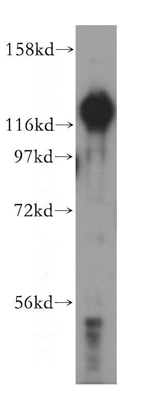 HRP 2 Rabbit Polyclonal antibody
