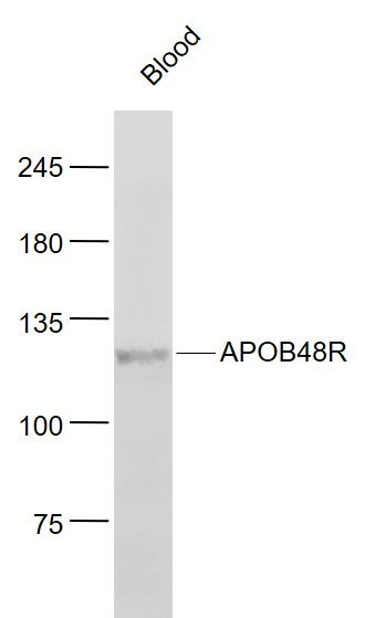 Fig1: Sample:; Blood(Mouse) Cell Lysate at 30 ug; Primary: Anti- APOB48R at 1/1000 dilution; Secondary: IRDye800CW Goat Anti-Rabbit IgG at 1/20000 dilution; Predicted band size: 115 kD; Observed band size: 115 kD