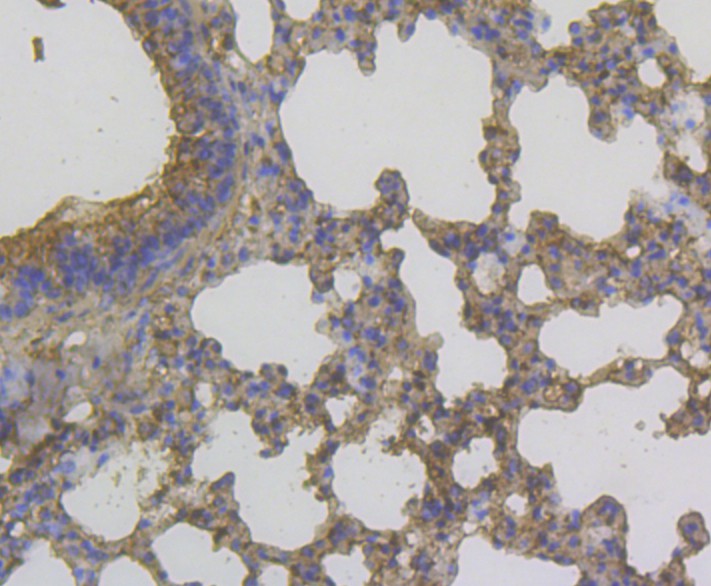 Fig4:; Immunohistochemical analysis of paraffin-embedded mouse lung tissue using anti-YKL-40 / CHI3L1 antibody. The section was pre-treated using heat mediated antigen retrieval with Tris-EDTA buffer (pH 8.0-8.4) for 20 minutes.The tissues were blocked in 5% BSA for 30 minutes at room temperature, washed with ddH; 2; O and PBS, and then probed with the antibody at 1/200 dilution, for 30 minutes at room temperature and detected using an HRP conjugated compact polymer system. DAB was used as the chrogen. Counter stained with hematoxylin and mounted with DPX.