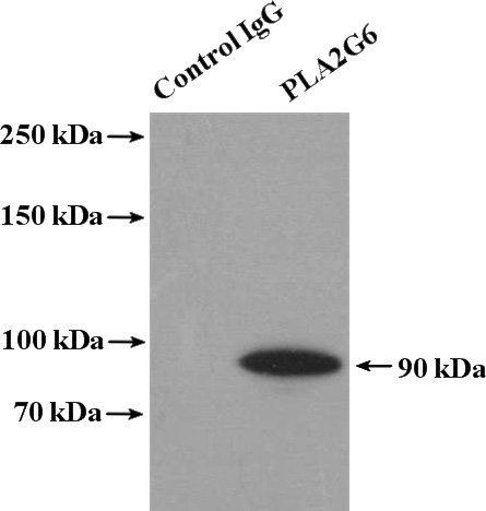 IP Result of anti-PLA2G6 (IP:Catalog No:111817, 4ug; Detection:Catalog No:111817 1:800) with mouse testis tissue lysate 4000ug.