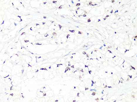 Immunohistochemistry - MTA2 Polyclonal Antibody 