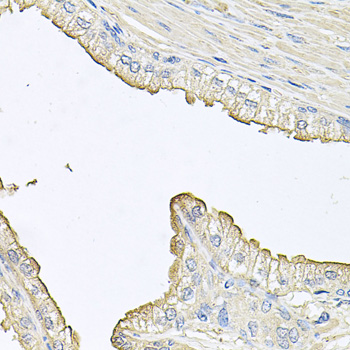 Immunohistochemistry - FABP12 Polyclonal Antibody 
