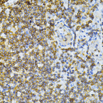 Immunohistochemistry - MT-ND5 Polyclonal Antibody 