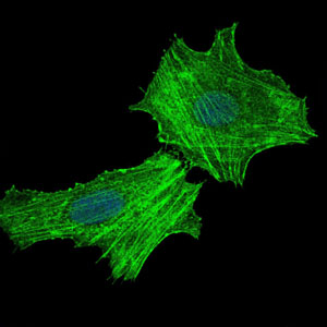 Immunofluorescence analysis of Hela cells using ASS1 mouse mAb (green). Blue