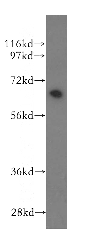Jurkat cells were subjected to SDS PAGE followed by western blot with Catalog No:117146(BIN1 antibody) at dilution of 1:500