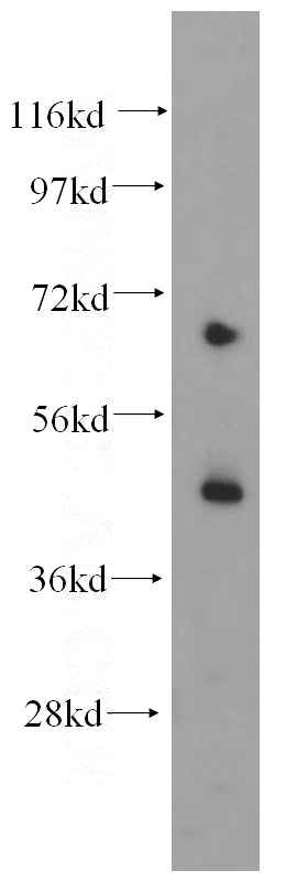 human heart tissue were subjected to SDS PAGE followed by western blot with Catalog No:112067(KCNJ11 antibody) at dilution of 1:200