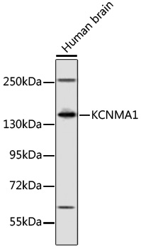 Western blot - KCNMA1 Polyclonal Antibody 