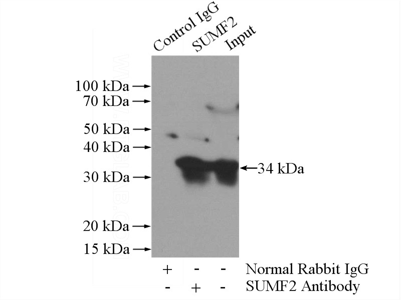 IP Result of anti-SUMF2 (IP:Catalog No:115835, 4ug; Detection:Catalog No:115835 1:500) with A431 cells lysate 1520ug.
