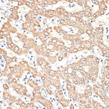 Immunohistochemistry - KIR3DS1 Polyclonal Antibody 