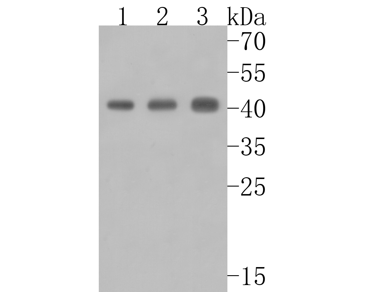Fig1:; Western blot analysis of ACAA2 on different lysates. Proteins were transferred to a PVDF membrane and blocked with 5% BSA in PBS for 1 hour at room temperature. The primary antibody ( 1/500) was used in 5% BSA at room temperature for 2 hours. Goat Anti-Rabbit IgG - HRP Secondary Antibody (HA1001) at 1:5,000 dilution was used for 1 hour at room temperature.; Positive control:; Lane 1: 293T cell lysate; Lane 2: Rat colon tissue lysate; Lane 3: NIH/3T3 cell lysate