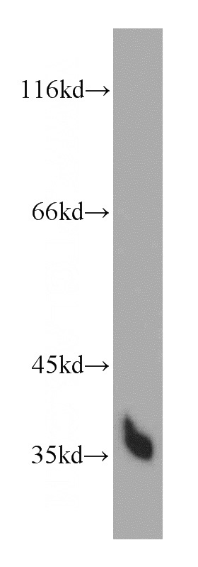 L02 cells were subjected to SDS PAGE followed by western blot with Catalog No:111714(HTRA1 antibody) at dilution of 1:600