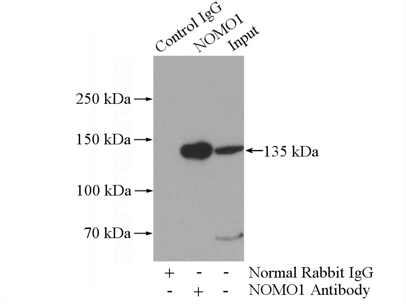 IP Result of anti-NOMO1 (IP:Catalog No:113300, 4ug; Detection:Catalog No:113300 1:1000) with A431 cells lysate 1520ug.