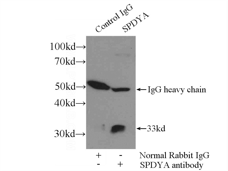 IP Result of anti-SPDYA (IP:Catalog No:115561, 3ug; Detection:Catalog No:115561 1:300) with mouse testis tissue lysate 4000ug.