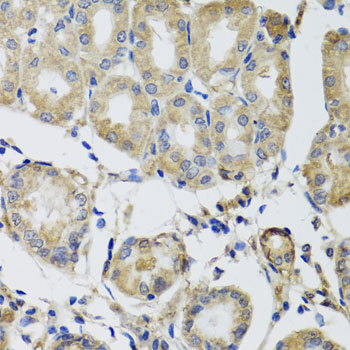 Immunohistochemistry - MRPS22 Polyclonal Antibody 