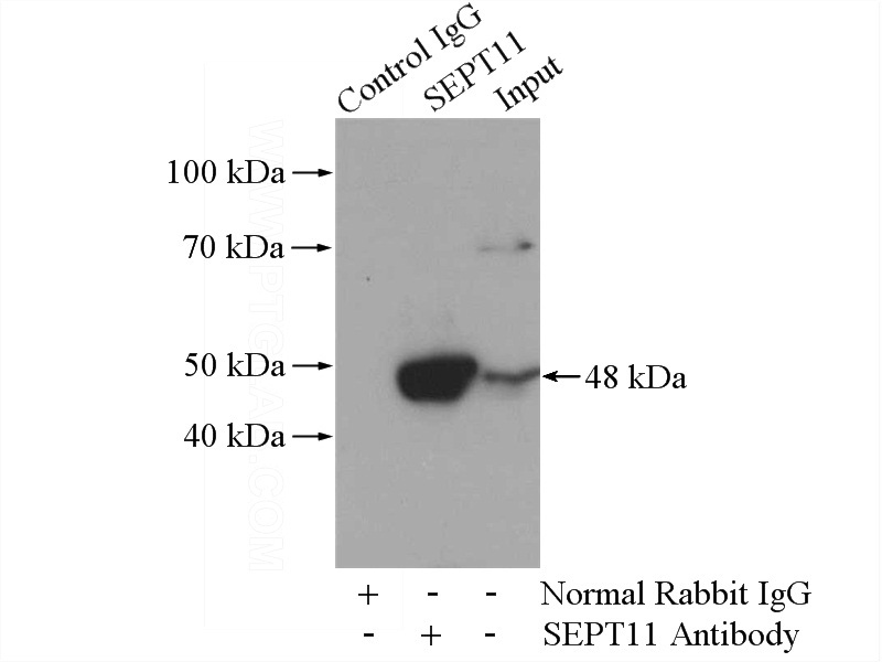 IP Result of anti-SEPT11 (IP:Catalog No:115115, 4ug; Detection:Catalog No:115115 1:500) with mouse brain tissue lysate 3440ug.