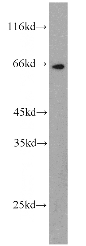 HEK-293 cells were subjected to SDS PAGE followed by western blot with Catalog No:112650(MAP3K2 antibody) at dilution of 1:1000