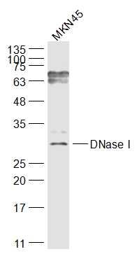 Fig2: Sample:; MKN45(Human) Cell Lysate at 30 ug; Primary: Anti-DNase I at 1/1000 dilution; Secondary: IRDye800CW Goat Anti-Rabbit IgG at 1/20000 dilution; Predicted band size: 29 kD; Observed band size: 29 kD