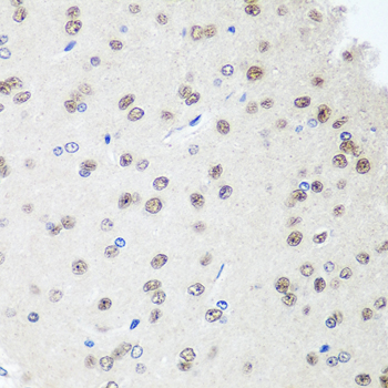 Immunohistochemistry - SAP18 Polyclonal Antibody 