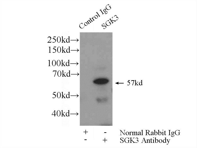 IP Result of anti-SGK3 (IP:Catalog No:115168, 4ug; Detection:Catalog No:115168 1:500) with mouse heart tissue lysate 3200ug.