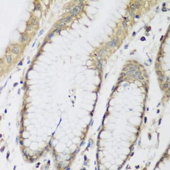 Immunohistochemistry - METTL7A Polyclonal Antibody 
