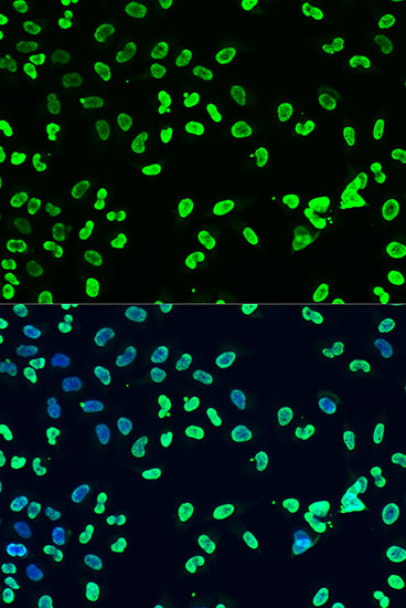 Immunofluorescence - DiMethyl-DNMT3A-K44 pAb 