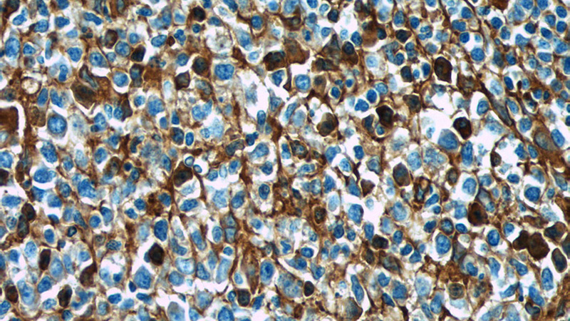 Immunohistochemistry of paraffin-embedded human tonsillitis tissue slide using Catalog No:111722(IGHG4 Antibody) at dilution of 1:50 (under 40x lens)