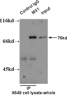 IP result of anti-MX1 (Catalog No:112908 for IP and Detection) with A549 cell.