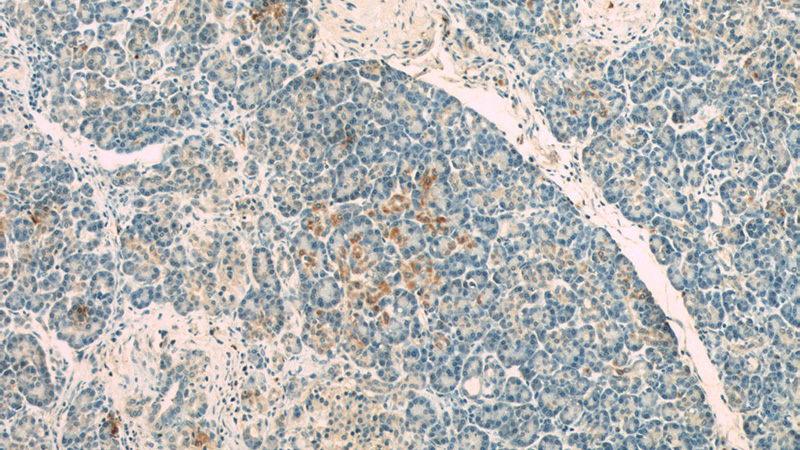 Immunohistochemistry of paraffin-embedded human pancreas slide using Catalog No:108880(CASP9 Antibody) at dilution of 1:50