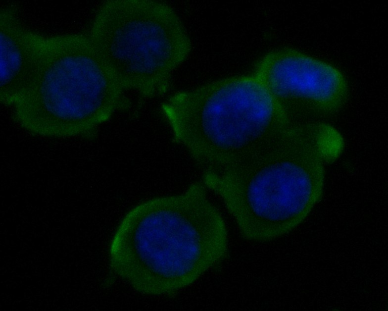 Fig2: ICC staining of KCNK18 in N2A cells (green). Formalin fixed cells were permeabilized with 0.1% Triton X-100 in TBS for 10 minutes at room temperature and blocked with 1% Blocker BSA for 15 minutes at room temperature. Cells were probed with the primary antibody ( 1/50) for 1 hour at room temperature, washed with PBS. Alexa Fluor®488 Goat anti-Rabbit IgG was used as the secondary antibody at 1/1,000 dilution. The nuclear counter stain is DAPI (blue).